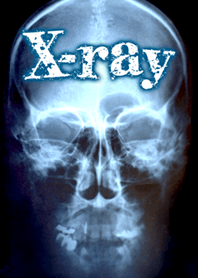 レントゲン X-ray
